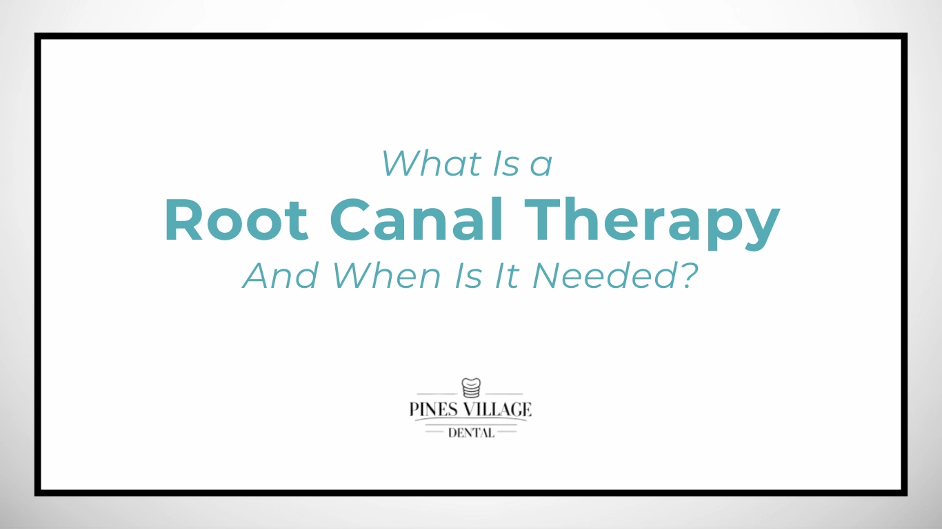 Root Canal Therapy