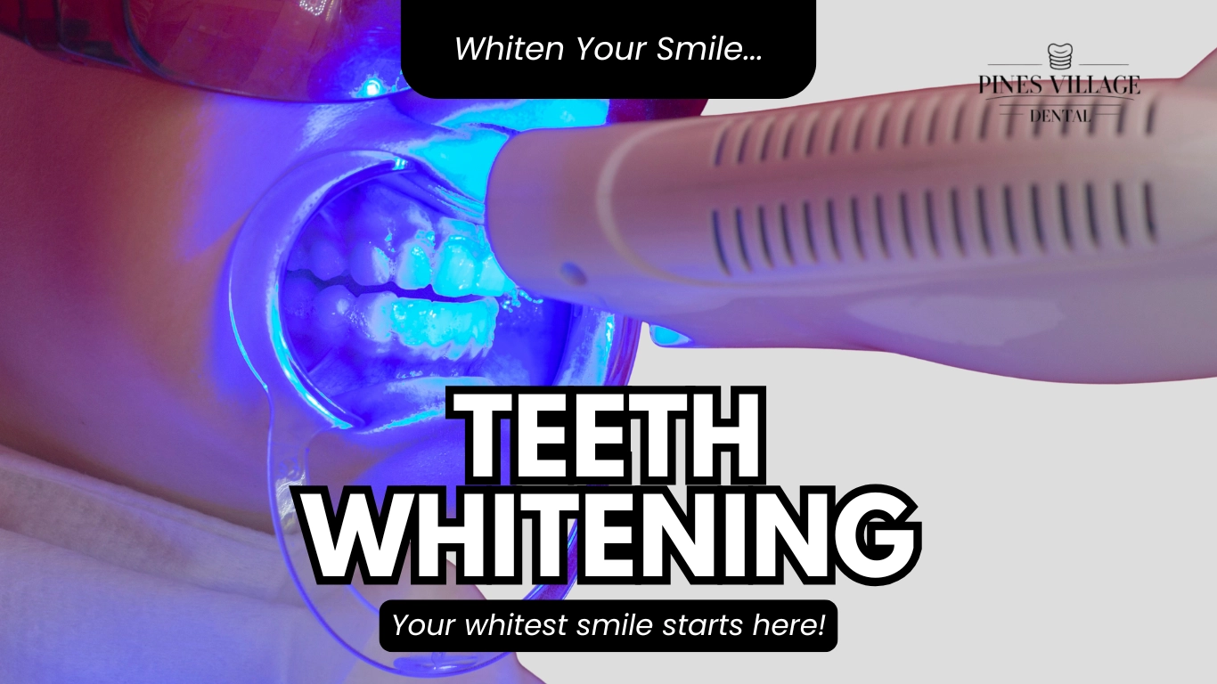 Professional Teeth Whitening in Pines Village | Pines Village Dental